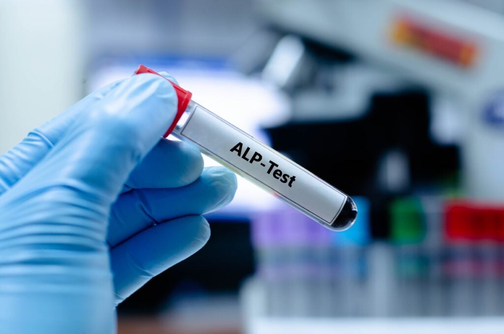 Low ALP, Think HPP: Clinical Pearls in Hypophosphatasia